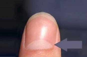 White mark on finger nail