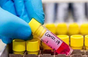 Coronavirus test online